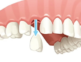 chirurgie orala